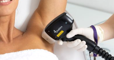 Underarm Laser Hair Removal